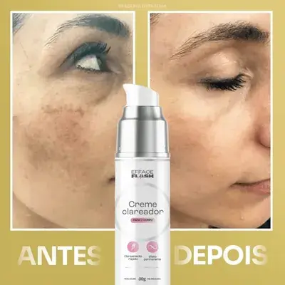 Antes e Depois Rosto