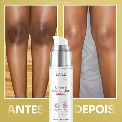 Antes e Depois Pernas